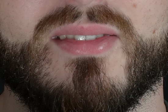 LipsMEN project - beard as a male life style - bearded men lovers